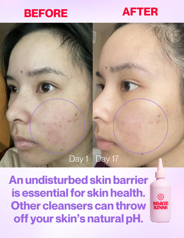 Silkie Rinse - Cleanser