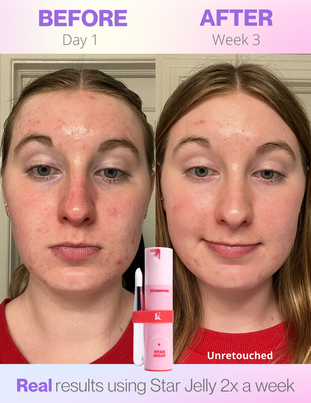Star Jelly Magic Resurfacing Facial Mask 💗🧪 – Kiramoon